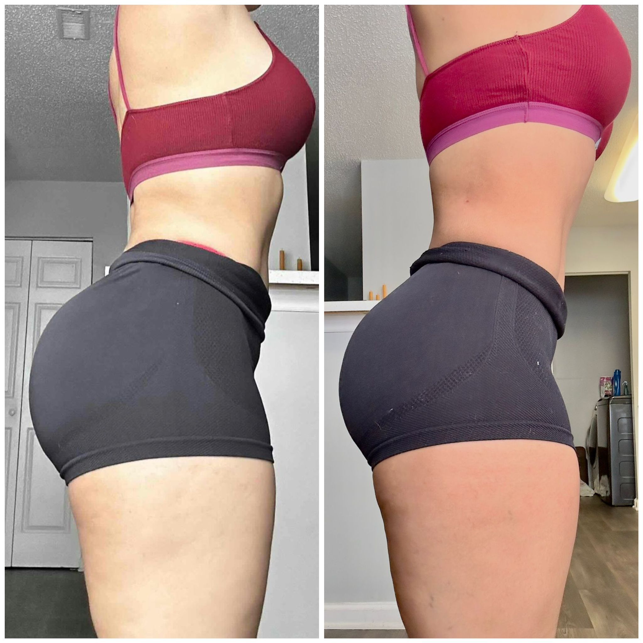 Before After photo 10