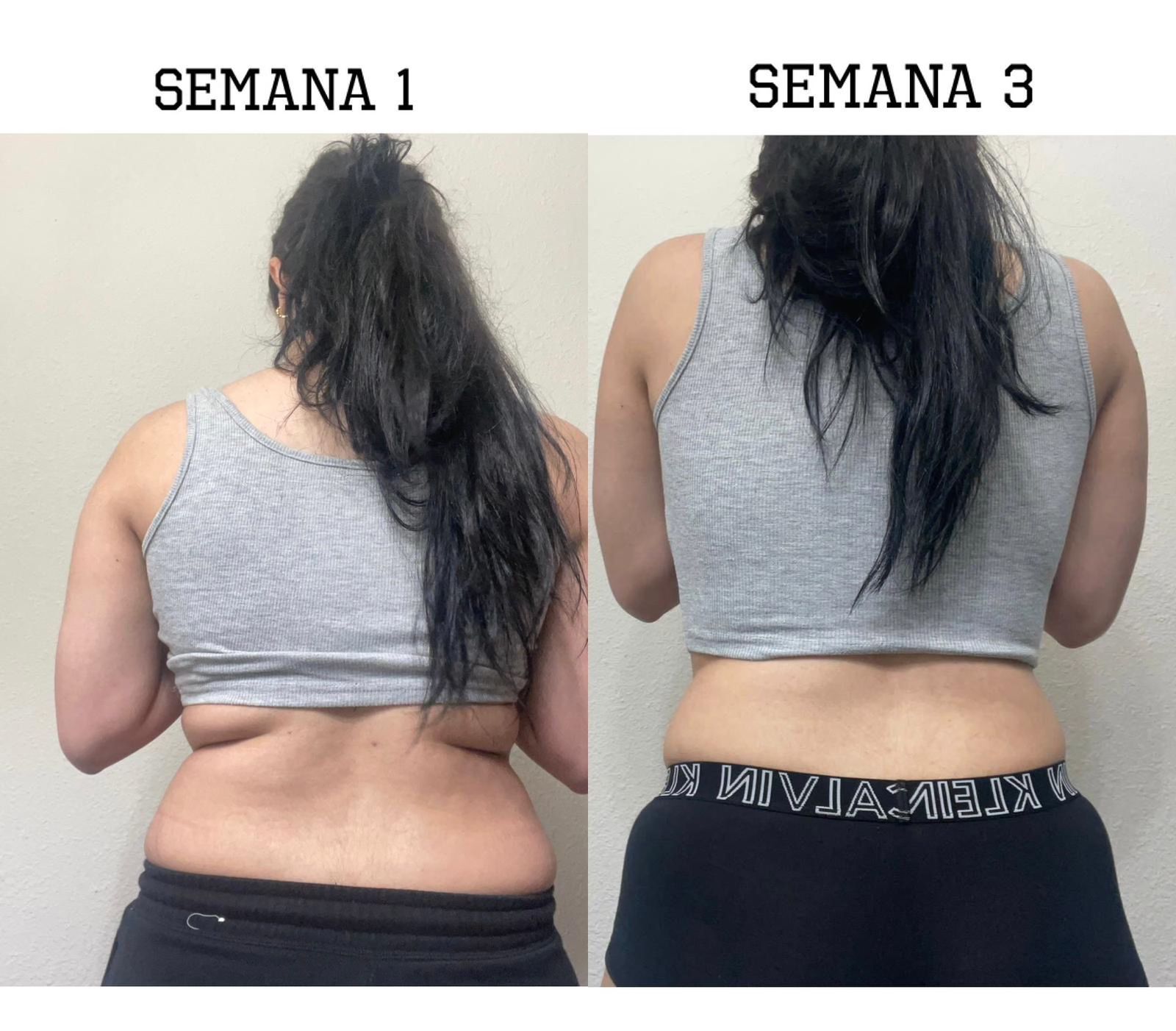 Before After photo 2