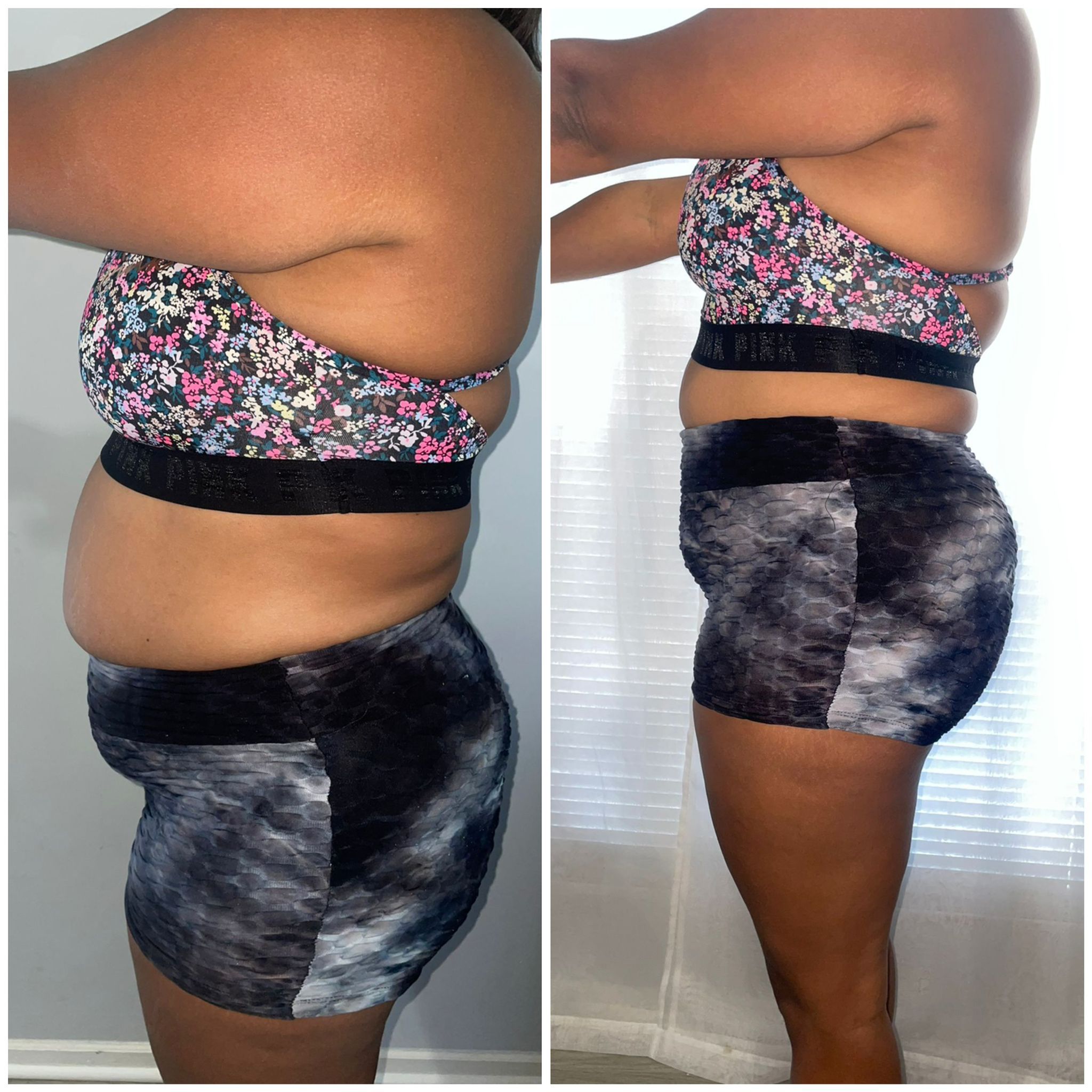 Before After photo 1